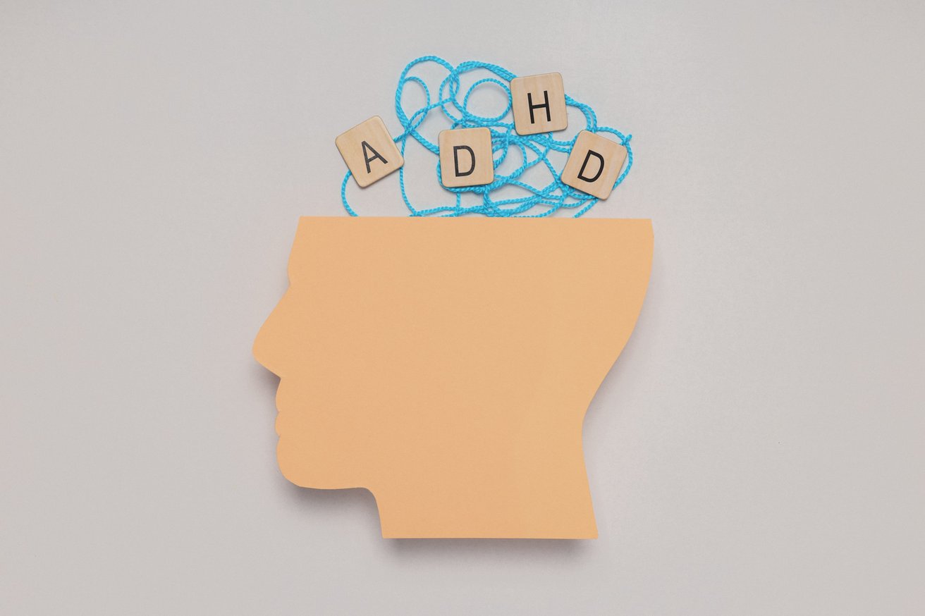 A light brown paper cutout of a human head in profile with tangled blue string and wooden letter tiles spelling 'ADHD' appearing above it. This conceptual image represents the mental health condition of ADHD.